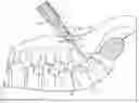 Fig. 01 - Spinal fixation tool attachment structure
