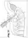 Fig. 14 - Spinal fixation tool attachment structure