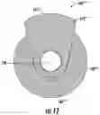 Fig. 09 - Implantable bone adjustment device with improved strength