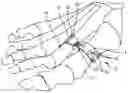 Fig. 01 - Implants and related methods for bunion correction