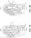 Fig. 02 - Implants and related methods for bunion correction