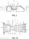 Fig. 07 - Implants and related methods for bunion correction