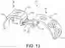 Fig. 09 - Implants and related methods for bunion correction
