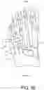 Fig. 33 - Implants and related methods for bunion correction