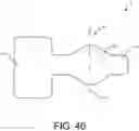Fig. 35 - Implants and related methods for bunion correction