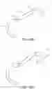 Fig. 37 - Implants and related methods for bunion correction