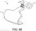 Fig. 41 - Implants and related methods for bunion correction