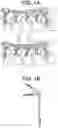 Fig. 02 - Longitudinally-adjustable bone anchors and related methods