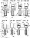 Fig. 06 - Longitudinally-adjustable bone anchors and related methods