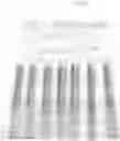 Fig. 09 - Electrosurgical electrode and method of manufacturing same