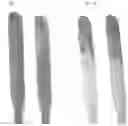 Fig. 14 - Electrosurgical electrode and method of manufacturing same