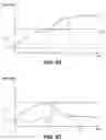 Fig. 12 - Medical device systems and methods for activating transducers based on delivery shaft member temperature