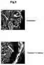 Fig. 09 - Inductive heating of tissues using alternating magnetic fields and uses thereof