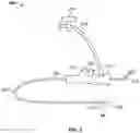 Fig. 03 - Bronchoscopic-based microwave ablation system and method