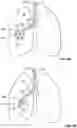 Fig. 07 - Bronchoscopic-based microwave ablation system and method