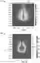 Fig. 10 - Bronchoscopic-based microwave ablation system and method