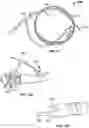 Fig. 11 - Bronchoscopic-based microwave ablation system and method