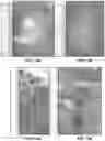 Fig. 12 - Bronchoscopic-based microwave ablation system and method