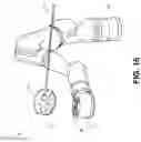 Fig. 16 - Bipolar medical instrument