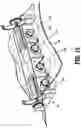 Fig. 12 - Drive unit and rack drape for robotic surgical instruments