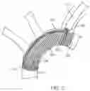 Fig. 08 - Accessory device to provide neuroprotection during interventional procedures