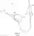 Fig. 07 - EMBOLIC PROTECTION SYSTEMS AND DEVICES