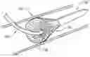 Fig. 01 - Intravascular Device With Multiple Leaflets