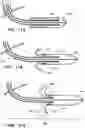 Fig. 09 - Intravascular Device With Multiple Leaflets
