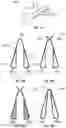 Fig. 18 - Nasal implants, delivery tools, systems, and methods of use