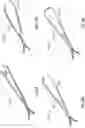 Fig. 28 - Nasal implants, delivery tools, systems, and methods of use