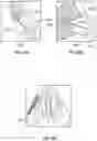 Fig. 33 - Nasal implants, delivery tools, systems, and methods of use