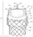 Fig. 01 - Surgical methods of replacing prosthetic heart valves