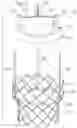 Fig. 02 - Surgical methods of replacing prosthetic heart valves