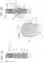 Fig. 03 - Prosthetic valve delivery system with independently-movable capsule portions
