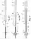 Fig. 04 - Transcatheter prosthetic heart valve delivery system with recapturing feature and method