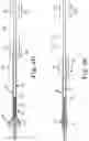 Fig. 05 - Transcatheter prosthetic heart valve delivery system with recapturing feature and method