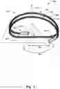 Fig. 02 - ANNULOPLASTY IMPLANT