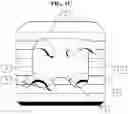 Fig. 04 - INTERBODY STANDALONE DEVICE WITH INTEGRATED FIXATIONS