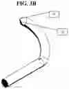 Fig. 10 - INTERBODY STANDALONE DEVICE WITH INTEGRATED FIXATIONS