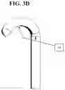 Fig. 12 - INTERBODY STANDALONE DEVICE WITH INTEGRATED FIXATIONS