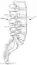 Fig. 01 - Intrabody Osteotomy Implant and Methods of Use