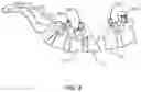 Fig. 06 - Intrabody Osteotomy Implant and Methods of Use