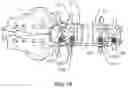 Fig. 08 - Intrabody Osteotomy Implant and Methods of Use
