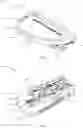 Fig. 02 - Unicompartmental knee arthroplasty