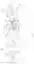 Fig. 02 - Prosthetic feedback apparatus and method