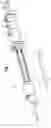 Fig. 02 - Deployment handle with stabilizing rail for a pre-loaded prosthesis delivery device