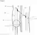 Fig. 07 - Minimally invasive surgical apparatus and methods