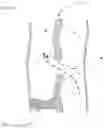 Fig. 08 - Minimally invasive surgical apparatus and methods