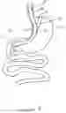 Fig. 03 - Activable bougie for performing gastroplasty