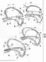 Fig. 03 - Devices and methods facilitating sleeve gastrectomy procedures